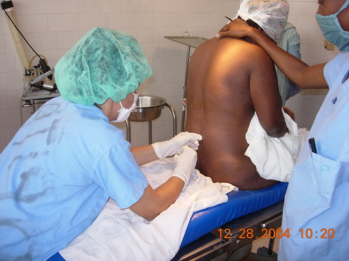 Spinal anesthesia